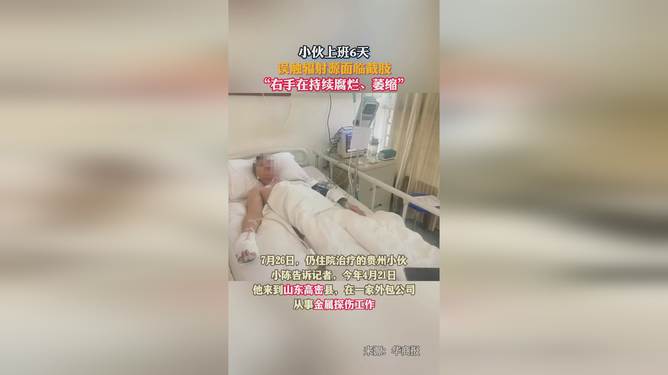 年輕小伙遭遇輻射危機(jī)，六日驚魂面臨截肢抉擇