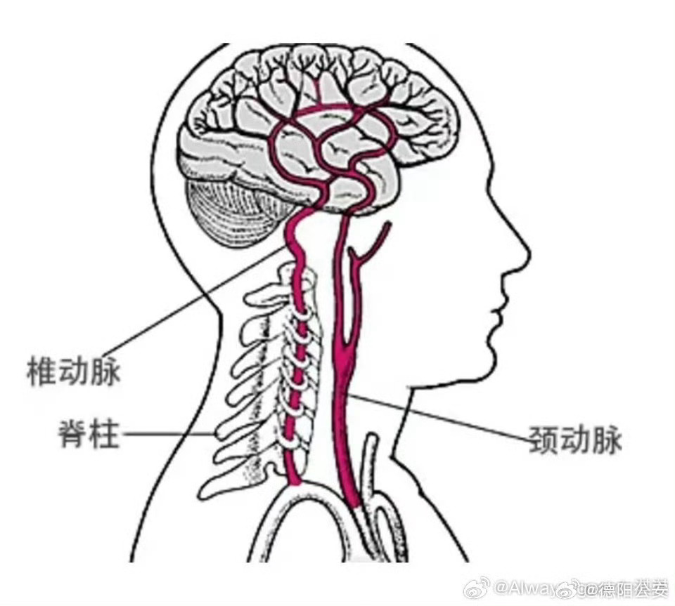 女子肩頸按摩后突發(fā)急性腦梗死，ICU緊急救治揭秘真相