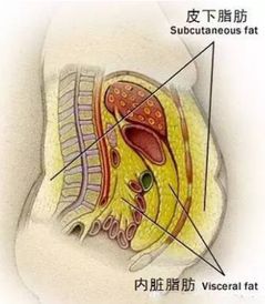 醫(yī)生警告，內(nèi)臟脂肪過多危害嚴重